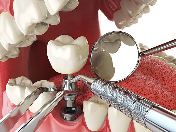 Best Emergency Dentist for Knocked-Out Tooth in Sugar Creek, MO