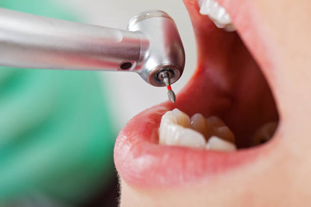 Best Broken or Cracked Tooth Emergency Dentist in Sugar Creek, MO
